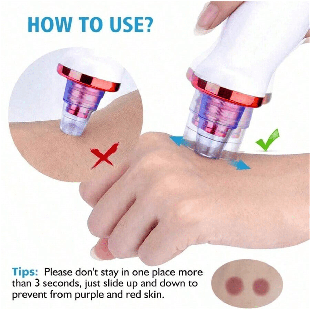 Pore Vacuum - 2026 Blackhead Remover Pimple Acne Removal
