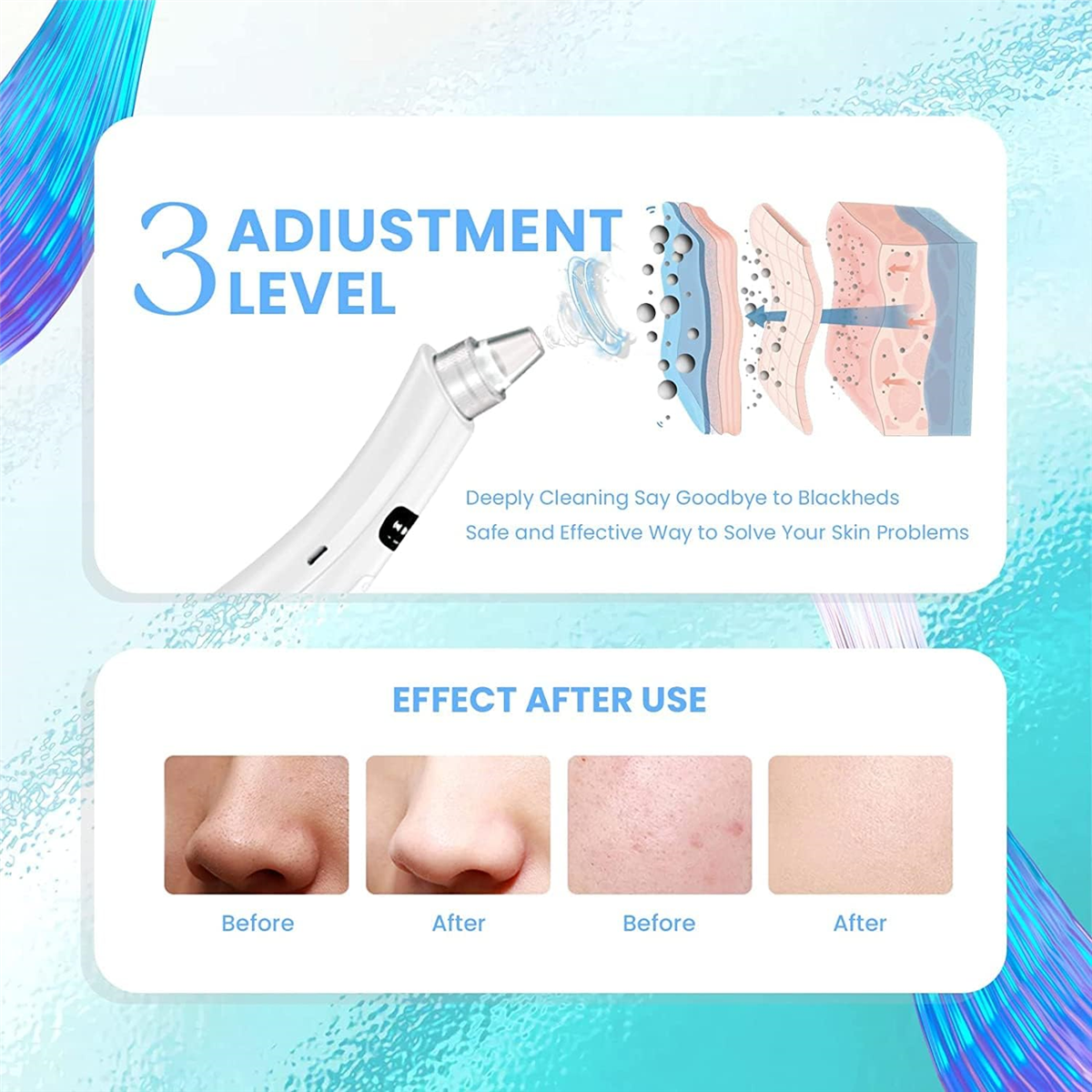 Pore Vacuum - Blackhead Remover Pore Vacuum,5 Suction Power,4