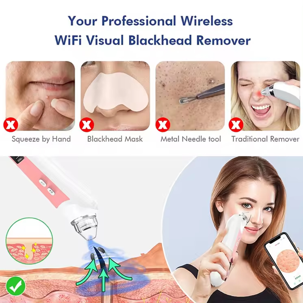 6 Heads Pore Cleaner Blackhead – Pore Vacuum Bewertung und Preis