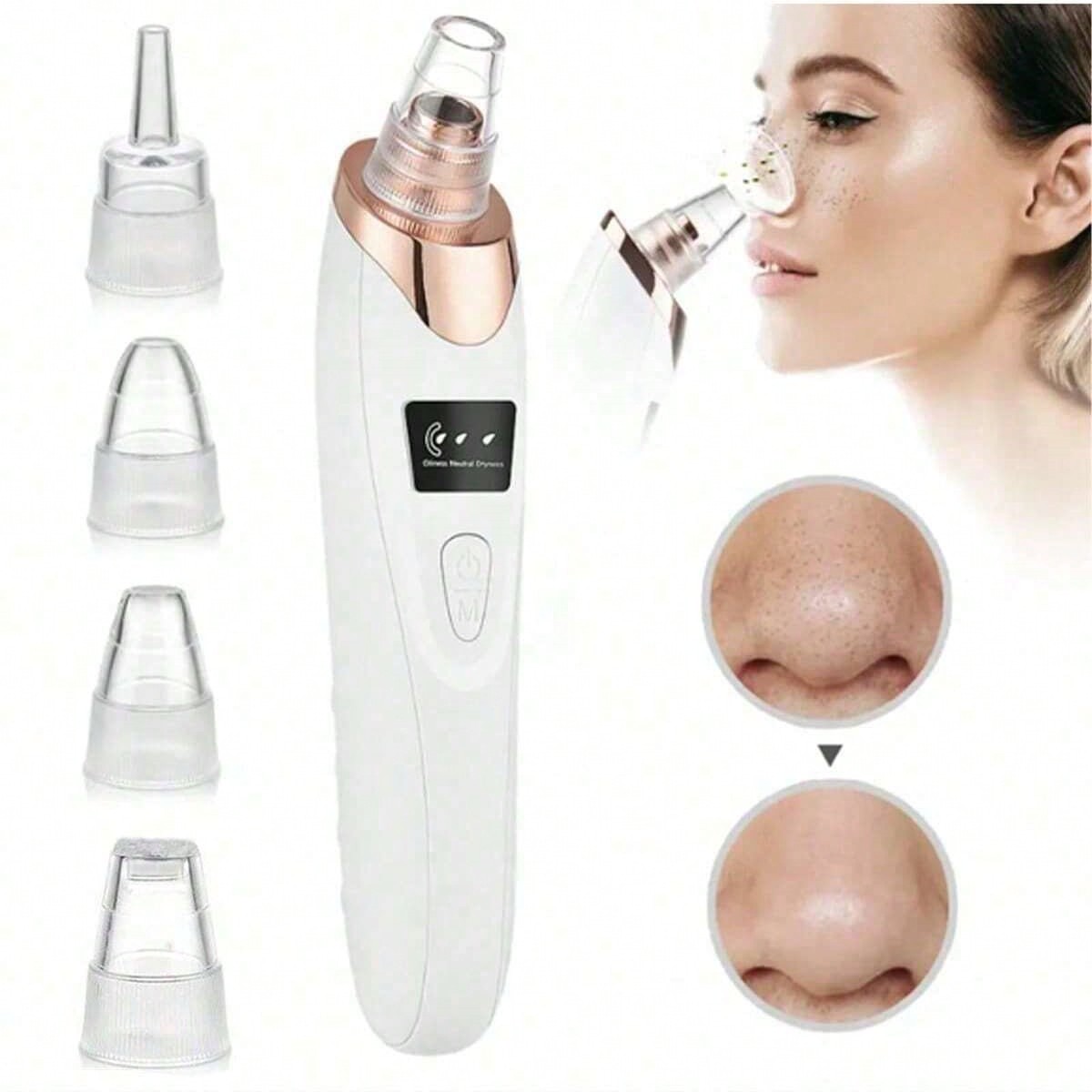 2026 Facial Pore Cleaner, 5 Su – Pore Vacuum Bewertung und Preis