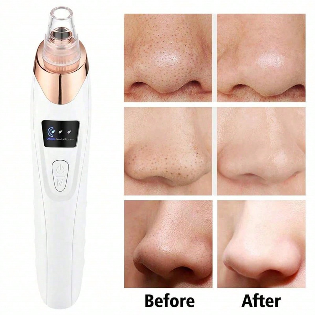 2026 Facial Pore Cleaner, 5 Su – Pore Vacuum Bewertung und Preis