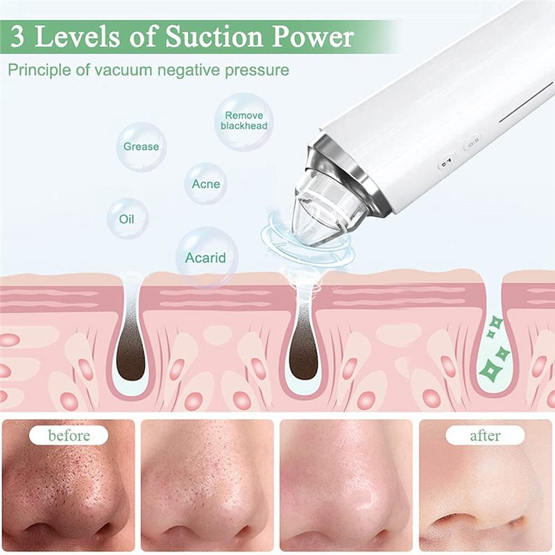 【FITTING】Blackhead Remover Por – Pore Vacuum Bewertung und Preis