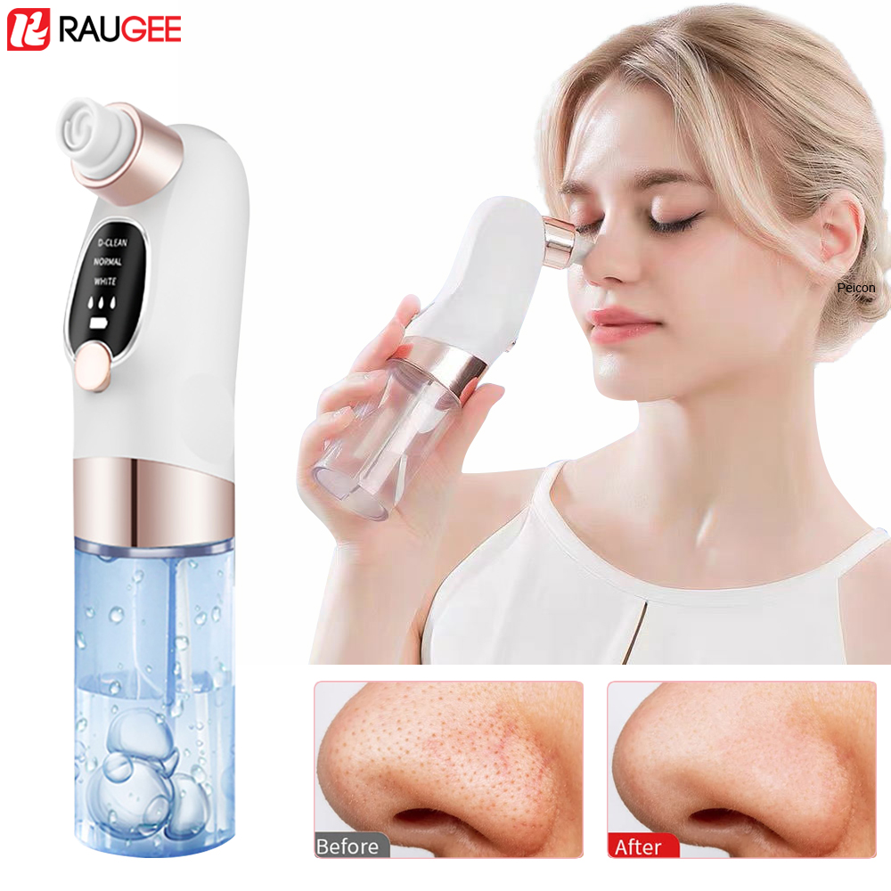 Blackhead Remover Electric Bla – Pore Vacuum Bewertung und Preis