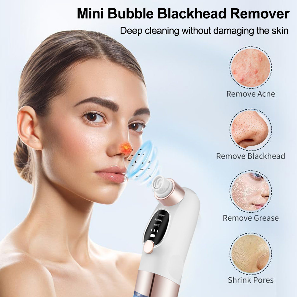 Blackhead Remover Electric Bla – Pore Vacuum Bewertung und Preis