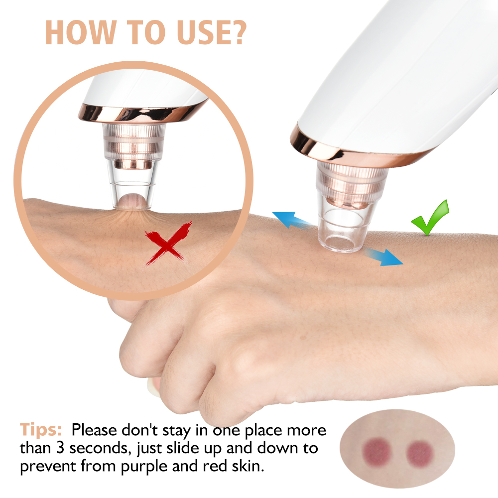 Blackhead Remover Vacuum Sucti – Pore Vacuum Bewertung und Preis