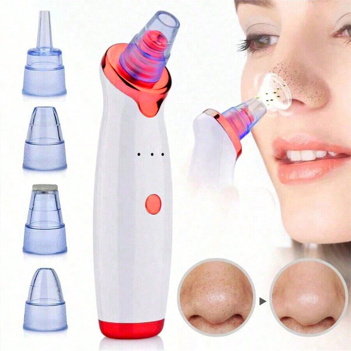 2026 Blackhead Remover Pimple  – Pore Vacuum Bewertung und Preis