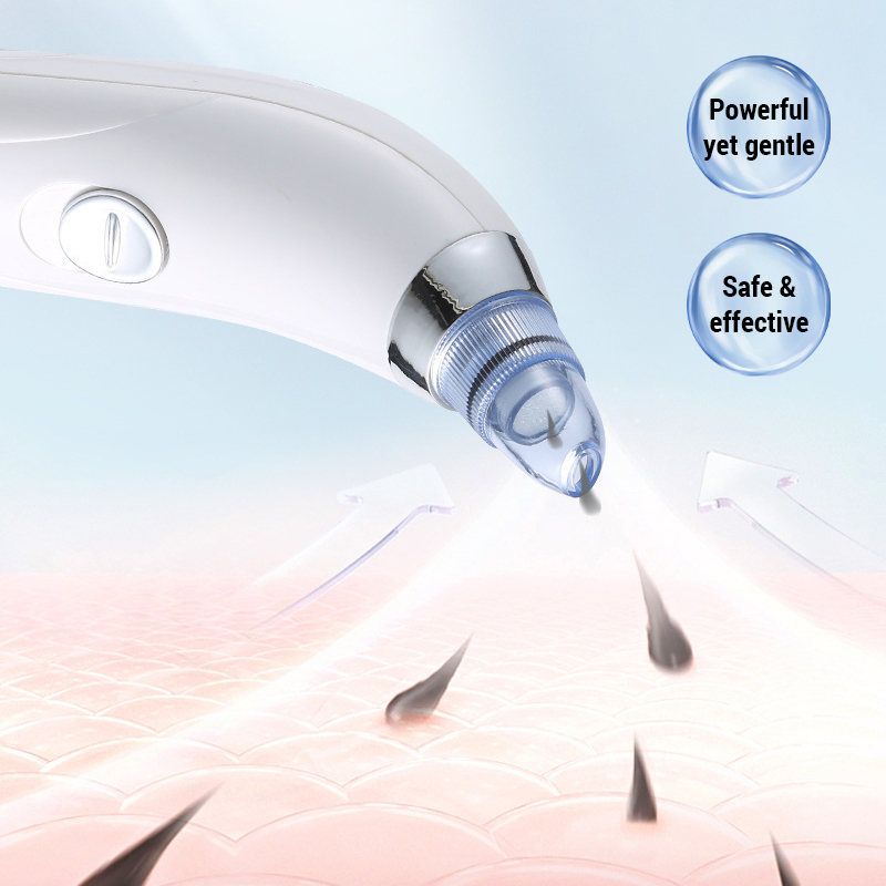 3 IN 1 Suction Blackheads God  – Pore Vacuum Bewertung und Preis