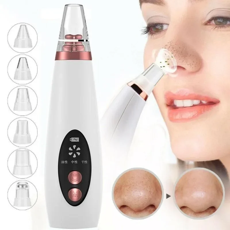 Blackhead Remover Vacuum Elect – Pore Vacuum Bewertung und Preis
